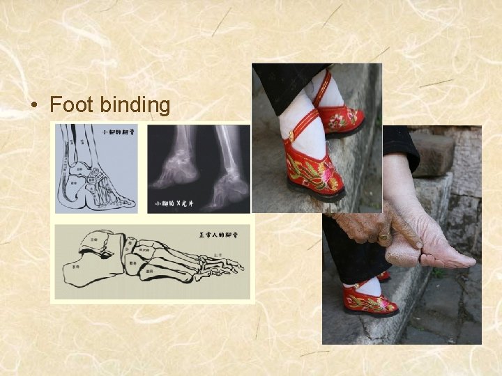  • Foot binding 