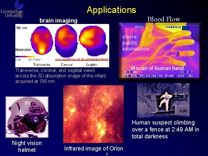 Applications Blood Flow brain imaging www. medphys. ucl. ac. uk/research/borl/ Transverse, coronal, and sagittal Applications Blood Flow brain imaging www. medphys. ucl. ac. uk/research/borl/ Transverse, coronal, and sagittal