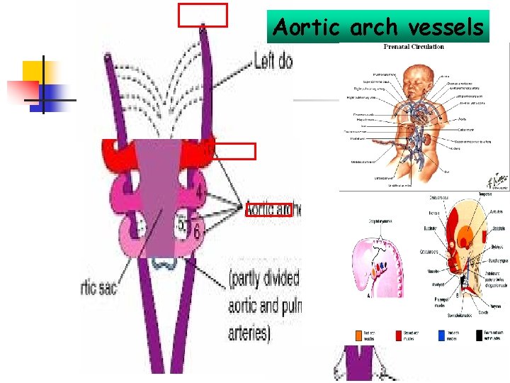 Aortic arch vessels 