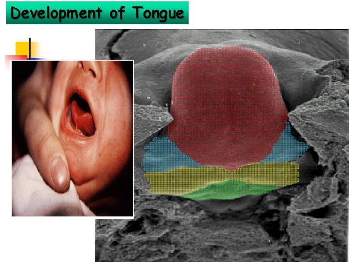 Development of Tongue 