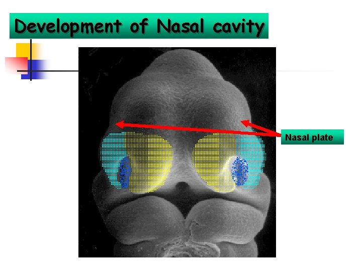 Development of Nasal cavity Nasal plate 