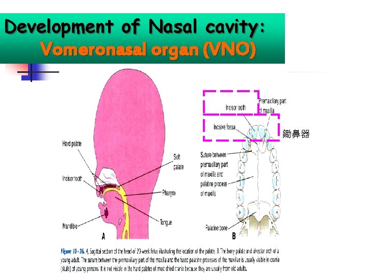 Development of Nasal cavity: Vomeronasal organ (VNO) 鋤鼻器 