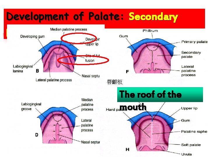 Development of Palate: Secondary palate 唇齦板 The roof of the mouth 