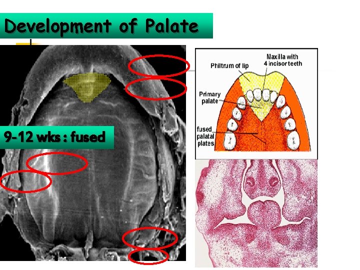 Development of Palate 9 -12 wks : fused 