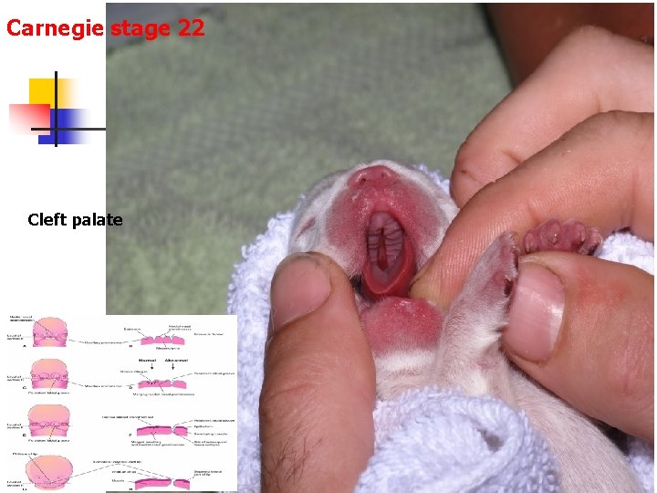 Carnegie stage 22 Cleft palate 