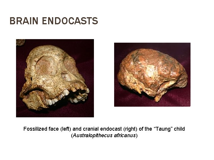 BRAIN ENDOCASTS Fossilized face (left) and cranial endocast (right) of the “Taung” child (Australopithecus