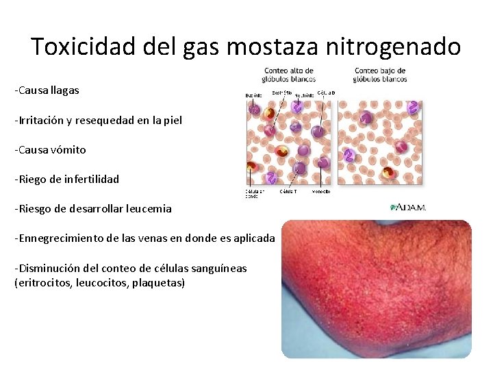 Toxicidad del gas mostaza nitrogenado -Causa llagas -Irritación y resequedad en la piel -Causa