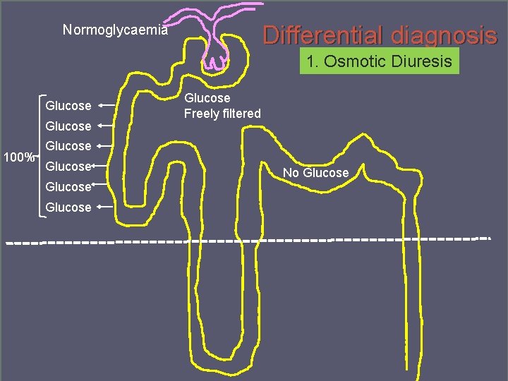 Differential diagnosis Normoglycaemia 1. Osmotic Diuresis Glucose 100% Glucose Freely filtered Glucose No Glucose