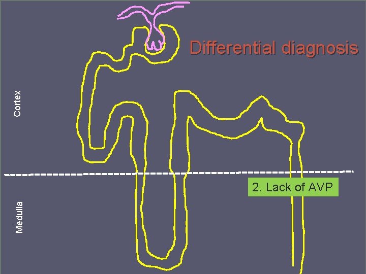 Cortex Differential diagnosis Medulla 2. Lack of AVP Denmark September 2014 