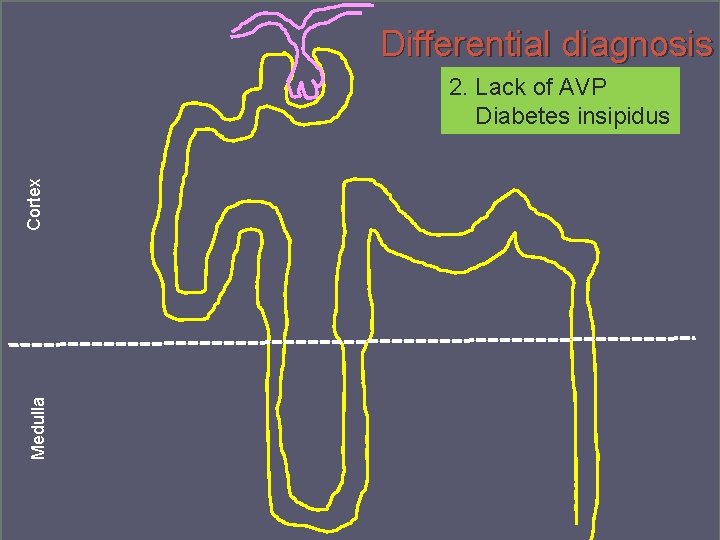 Differential diagnosis Medulla Cortex 2. Lack of AVP Diabetes insipidus Denmark September 2014 