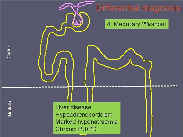 Differential diagnosis Medulla Cortex 4. Medullary Washout Liver disease Hypoadrenocorticism Marked hyponatraemia Chronic PU/PD