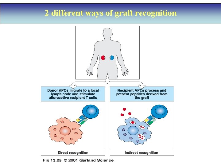 2 different ways of graft recognition 