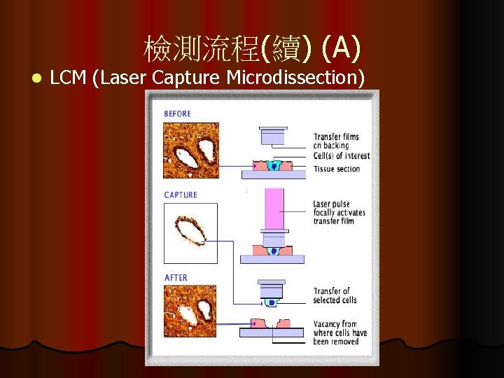 檢測流程(續) (A) l LCM (Laser Capture Microdissection) 