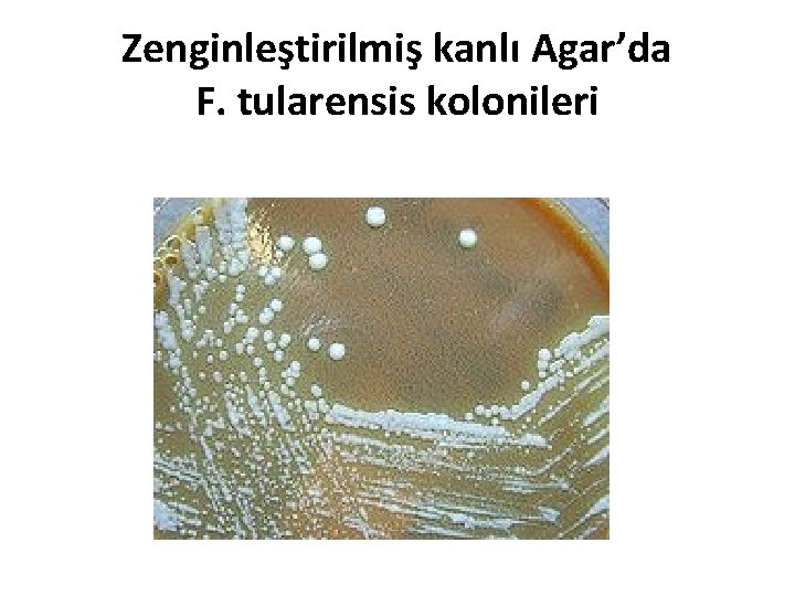 Zenginleştirilmiş kanlı Agar’da F. tularensis kolonileri 