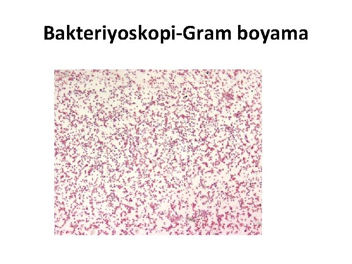 Bakteriyoskopi-Gram boyama 