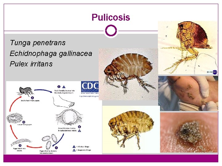 Pulicosis Tunga penetrans Echidnophaga gallinacea Pulex irritans 