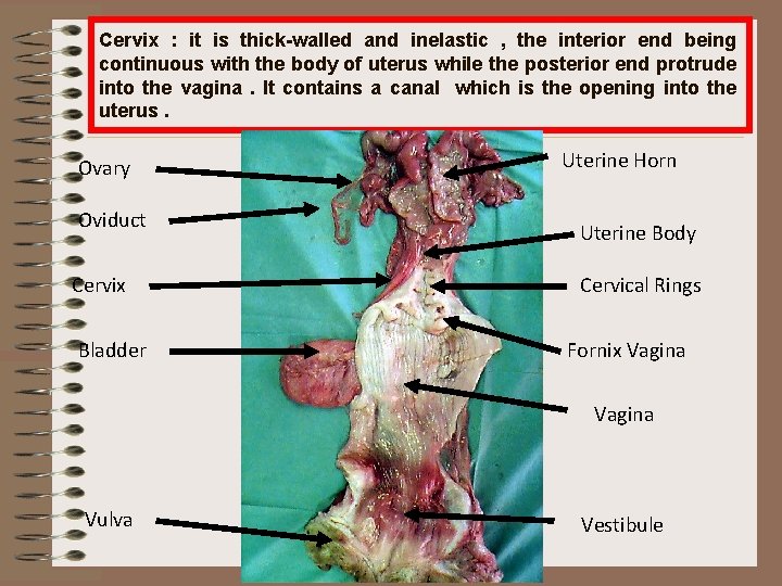 Cervix : it is thick-walled and inelastic , the interior end being continuous with