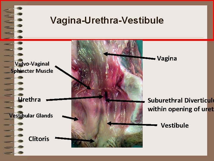 Vagina-Urethra-Vestibule Vulvo-Vaginal Sphincter Muscle Urethra Vestibular Glands Vagina Suburethral Diverticulu within opening of ureth