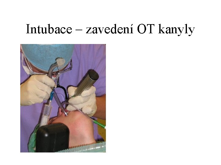 Intubace – zavedení OT kanyly 