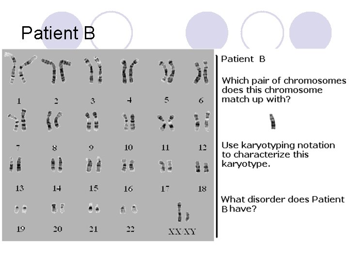 Patient B 