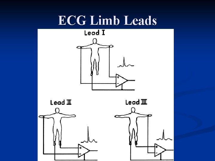 ECG Limb Leads 