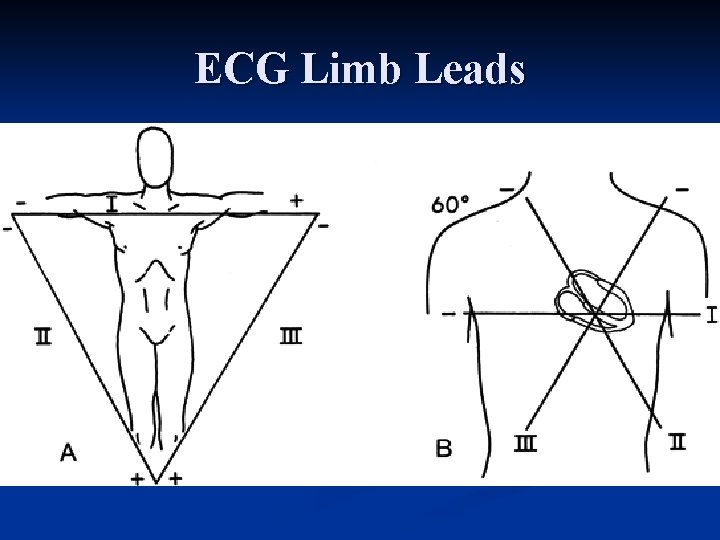 ECG Limb Leads 