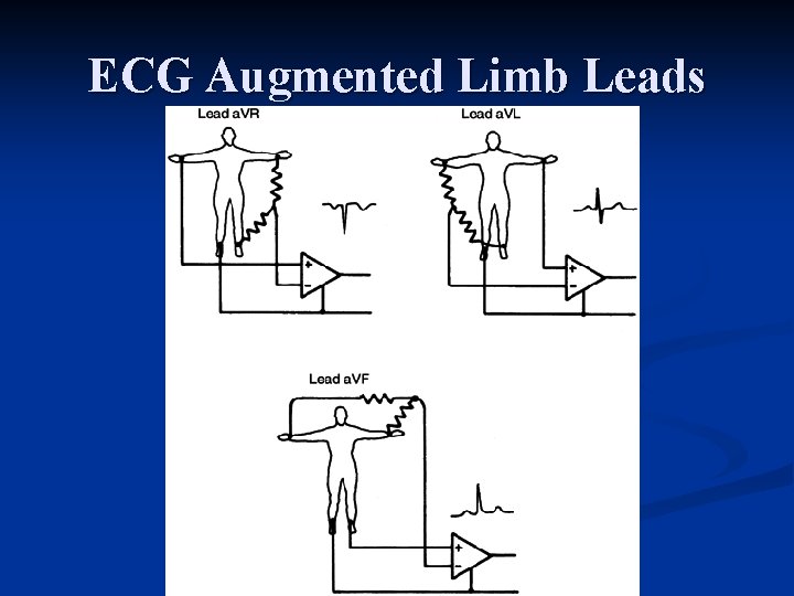 ECG Augmented Limb Leads 