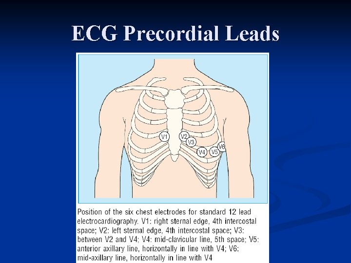 ECG Precordial Leads 
