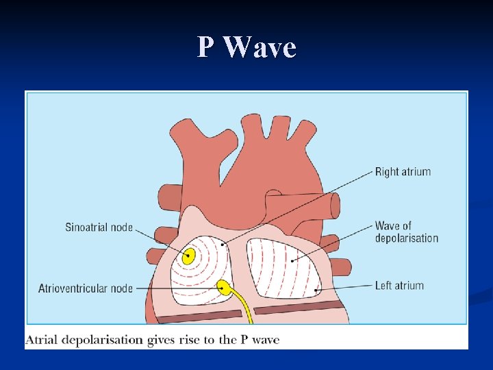P Wave 