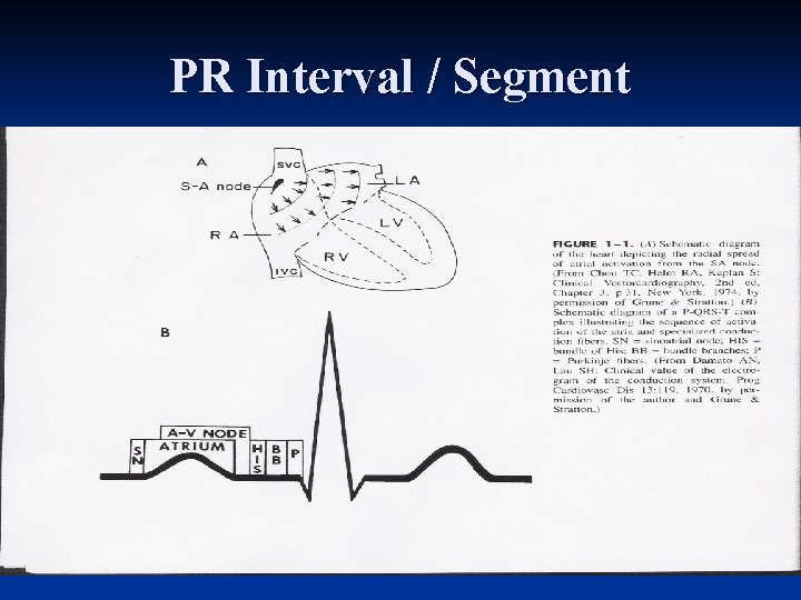 PR Interval / Segment 