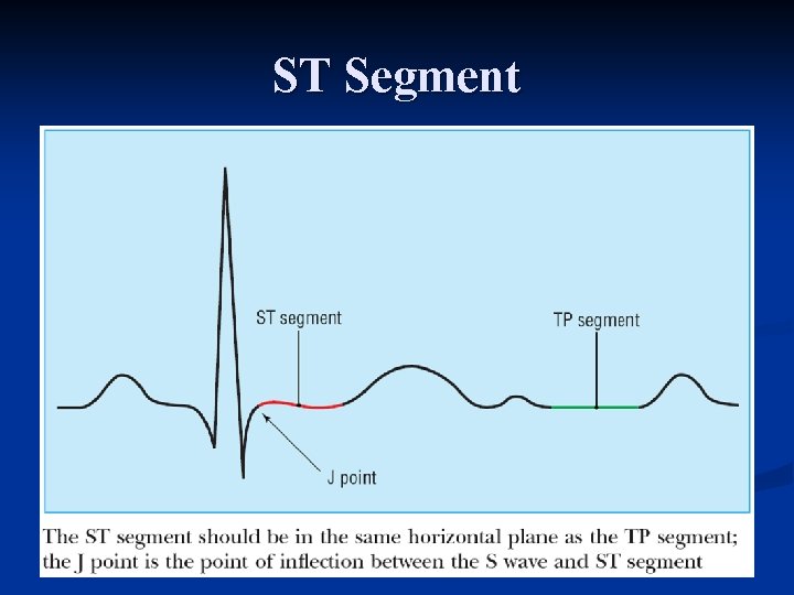 ST Segment 