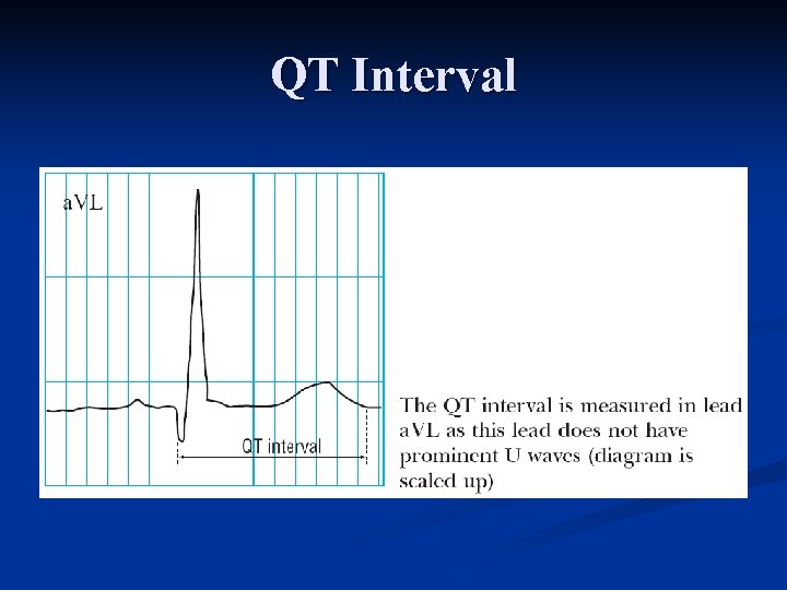 QT Interval 