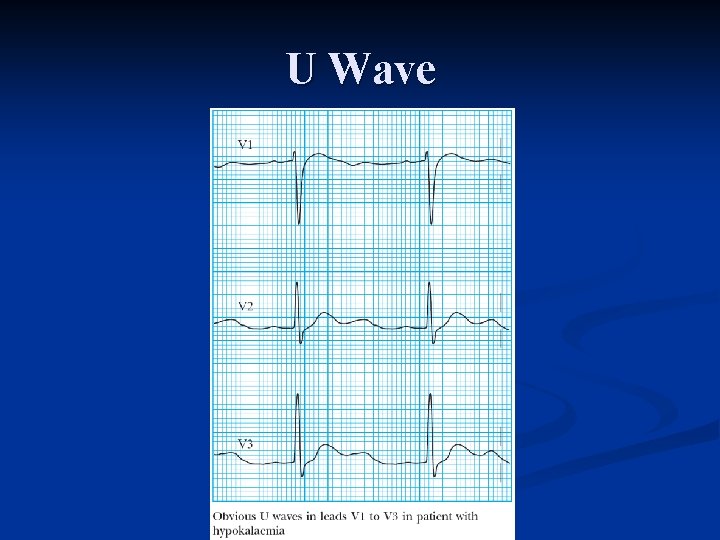 U Wave 