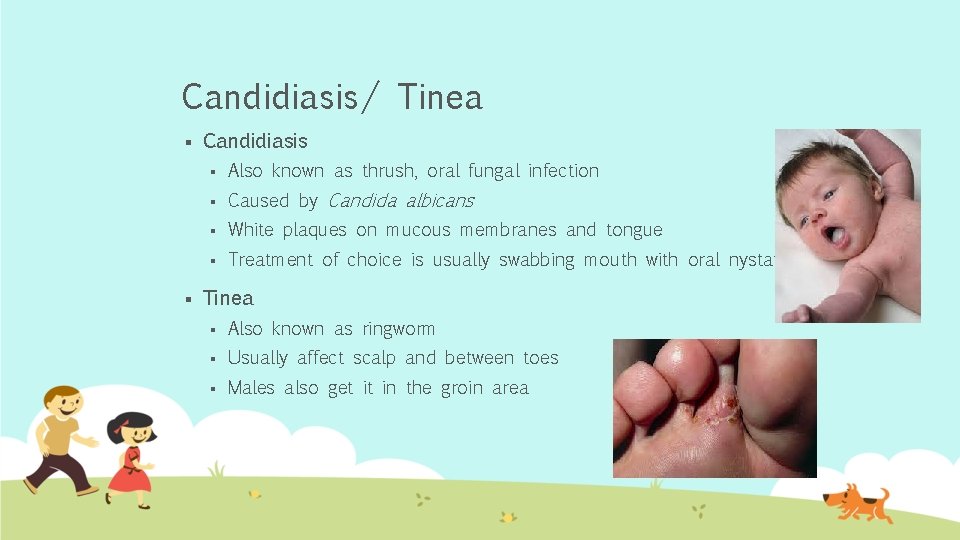 Candidiasis/ Tinea § § Candidiasis § Also known as thrush, oral fungal infection §
