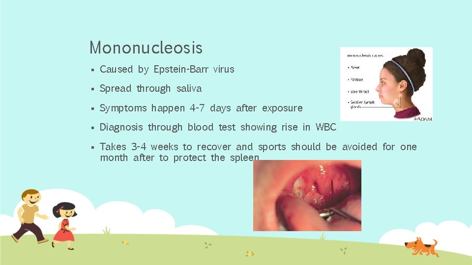 Mononucleosis § Caused by Epstein-Barr virus § Spread through saliva § Symptoms happen 4