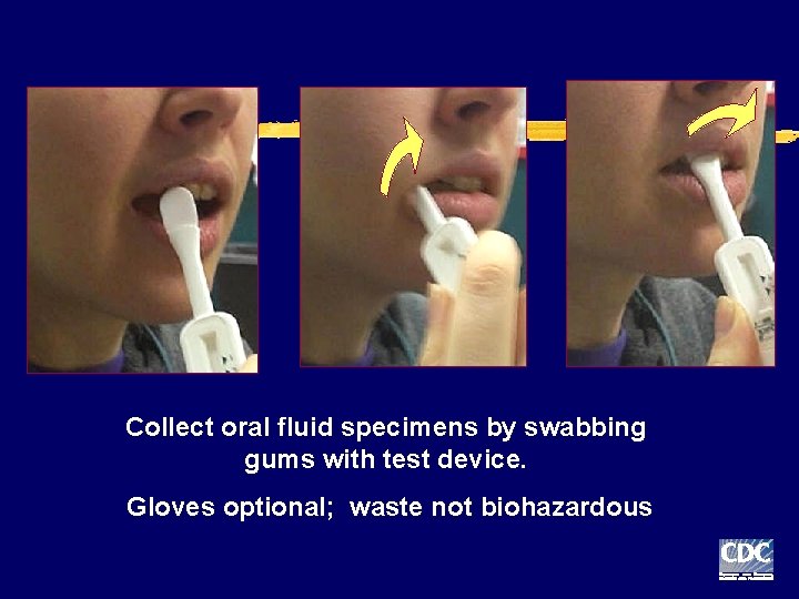 Collect oral fluid specimens by swabbing gums with test device. Gloves optional; waste not