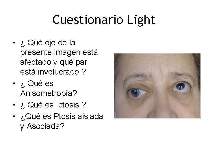 Cuestionario Light • ¿ Qué ojo de la presente imagen está afectado y qué