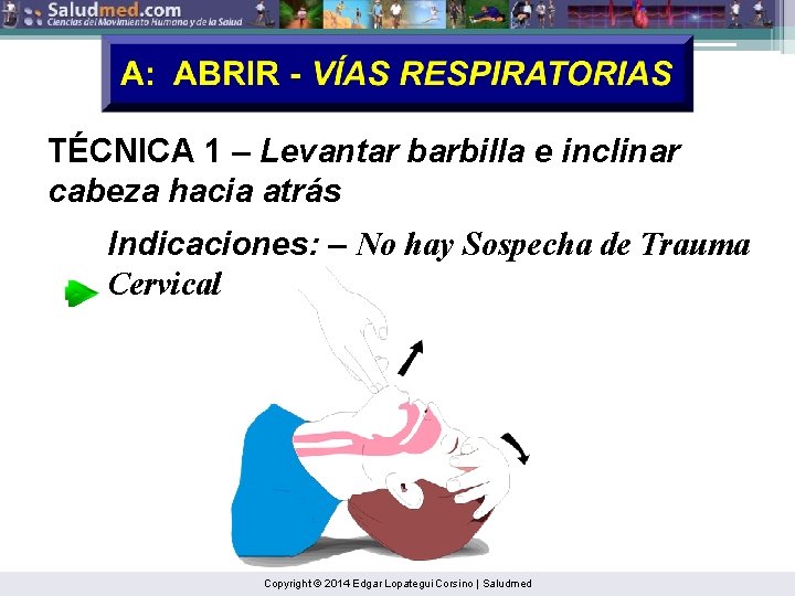 TÉCNICA 1 – Levantar barbilla e inclinar cabeza hacia atrás Indicaciones: – No hay