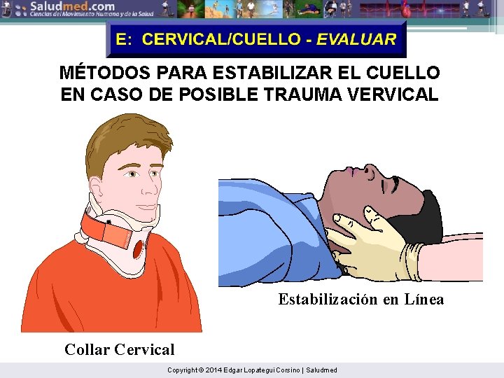 MÉTODOS PARA ESTABILIZAR EL CUELLO EN CASO DE POSIBLE TRAUMA VERVICAL Estabilización en Línea