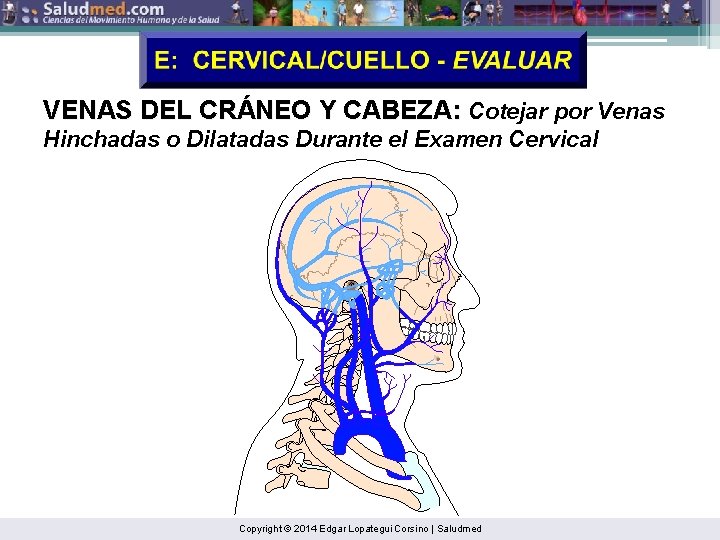 VENAS DEL CRÁNEO Y CABEZA: Cotejar por Venas Hinchadas o Dilatadas Durante el Examen