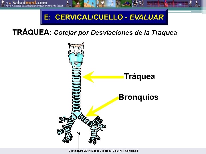 TRÁQUEA: Cotejar por Desviaciones de la Traquea Tráquea Bronquios Copyright © 2014 Edgar Lopategui