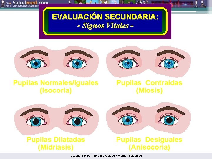 EVALUACIÓN SECUNDARIA: - Signos Vitales - Pupilas Normales/Iguales (Isocoria) Pupilas Contraidas (Miosis) Pupilas Dilatadas