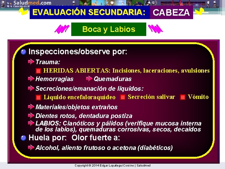 EVALUACIÓN SECUNDARIA: CABEZA Boca y Labios Inspecciones/observe por: Trauma: HERIDAS ABIERTAS: Incisiones, laceraciones, avulsiones