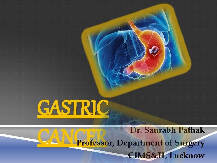 GASTRIC CANCER Dr. Saurabh Pathak Professor, Department of Surgery CIMS&H, Lucknow 