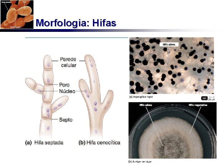Morfologia: Hifas 
