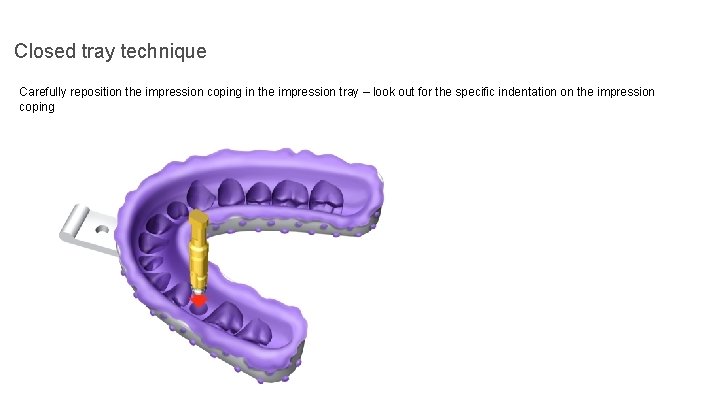 Closed tray technique Carefully reposition the impression coping in the impression tray – look