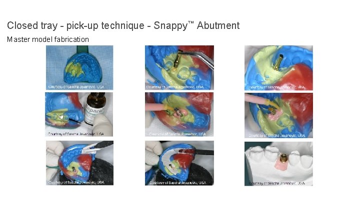 Closed tray - pick-up technique - Snappy™ Abutment Master model fabrication 