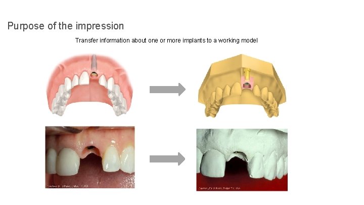 Purpose of the impression Transfer information about one or more implants to a working