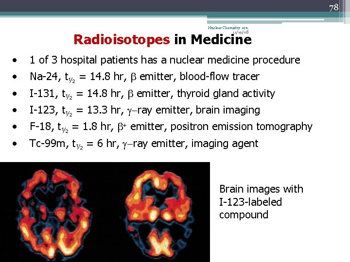 78 Nuclear Chemistry rev. 11/19/08 Radioisotopes in Medicine • 1 of 3 hospital patients