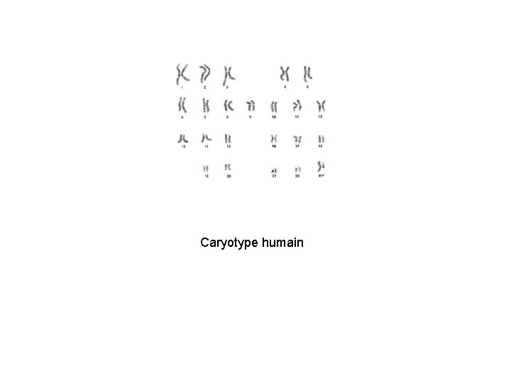 Caryotype humain 